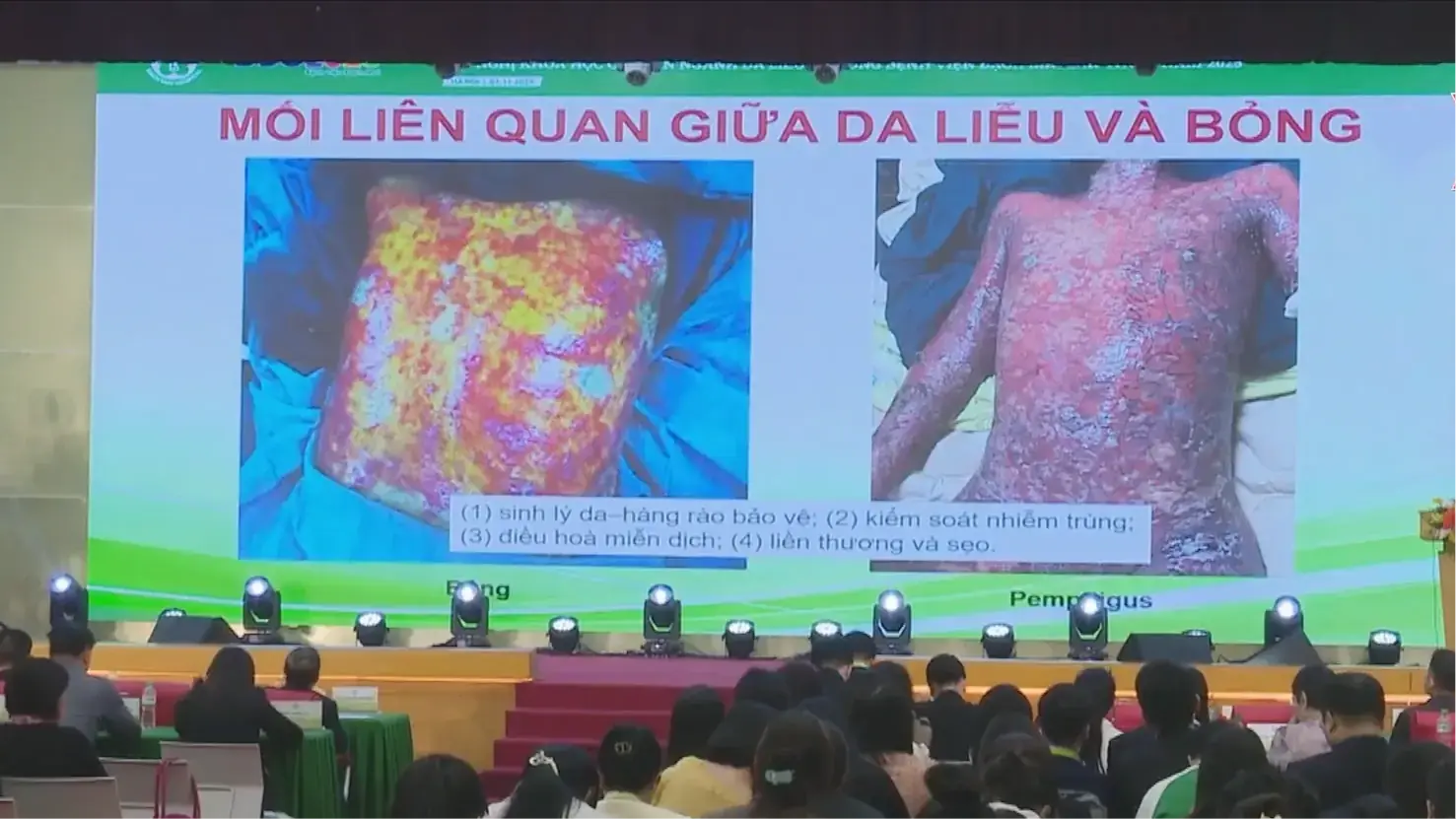 Cập nhật nhiều kỹ thuật mới trong điều trị da liễu, bỏng